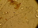 Nesselkapseln von Pelagia noctiluca